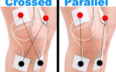 BEST Tens Placement for Knee Pain