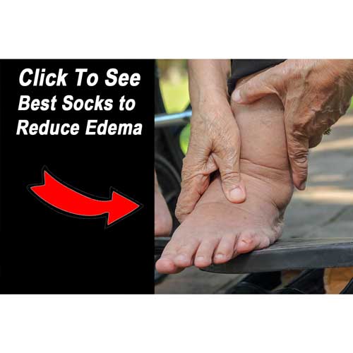 Best Socks to Reduce Edema