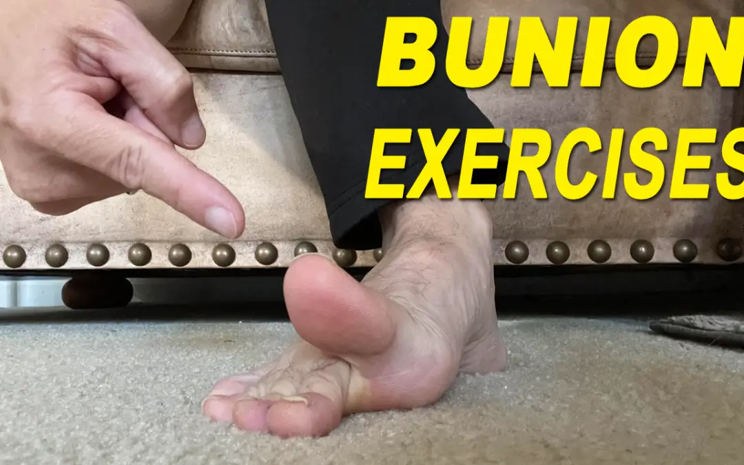 Do Toe Spacers Help Bunions