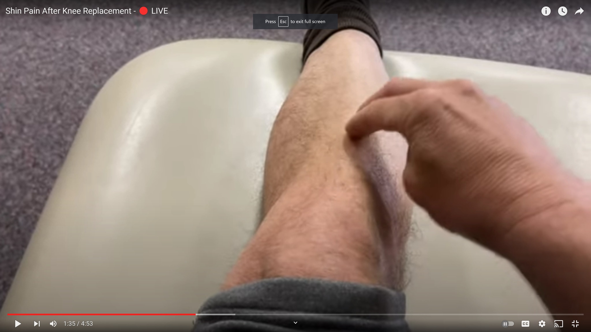 shin pain after total knee replacement