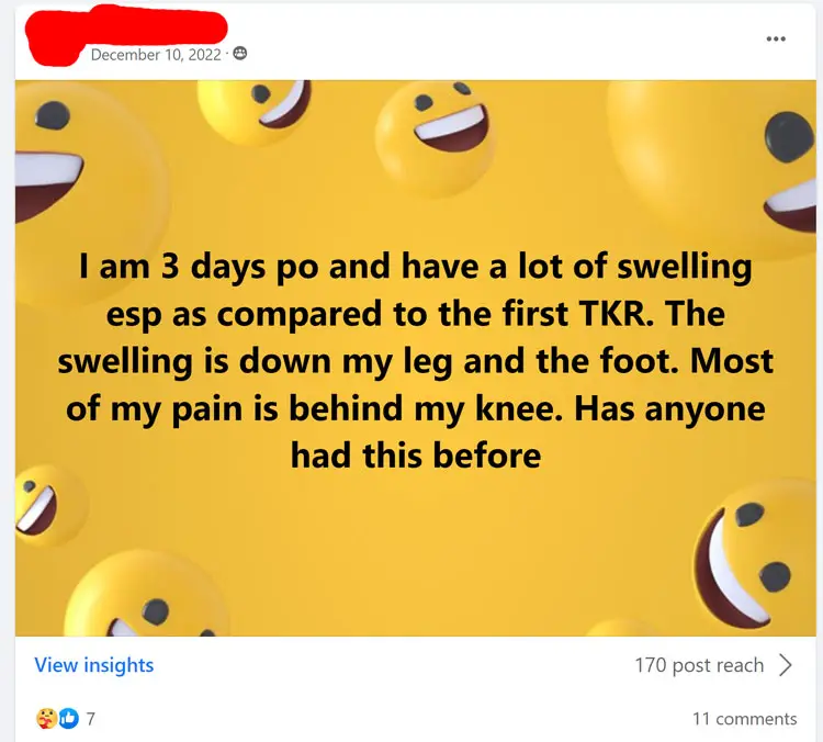 Facebook Question About Foot Swelling
