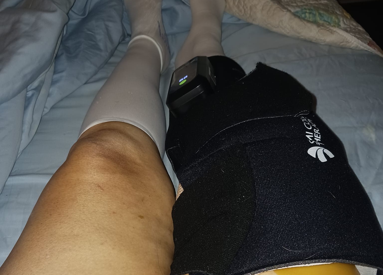 Ice Pack on Knee After Knee Replacement Surgery